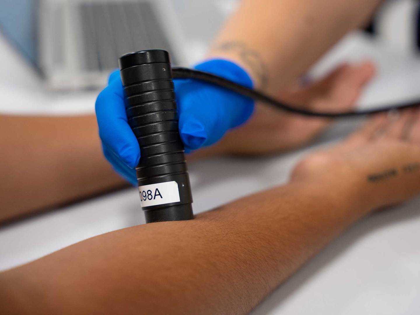 Panelist's arm being clinically tested with machine