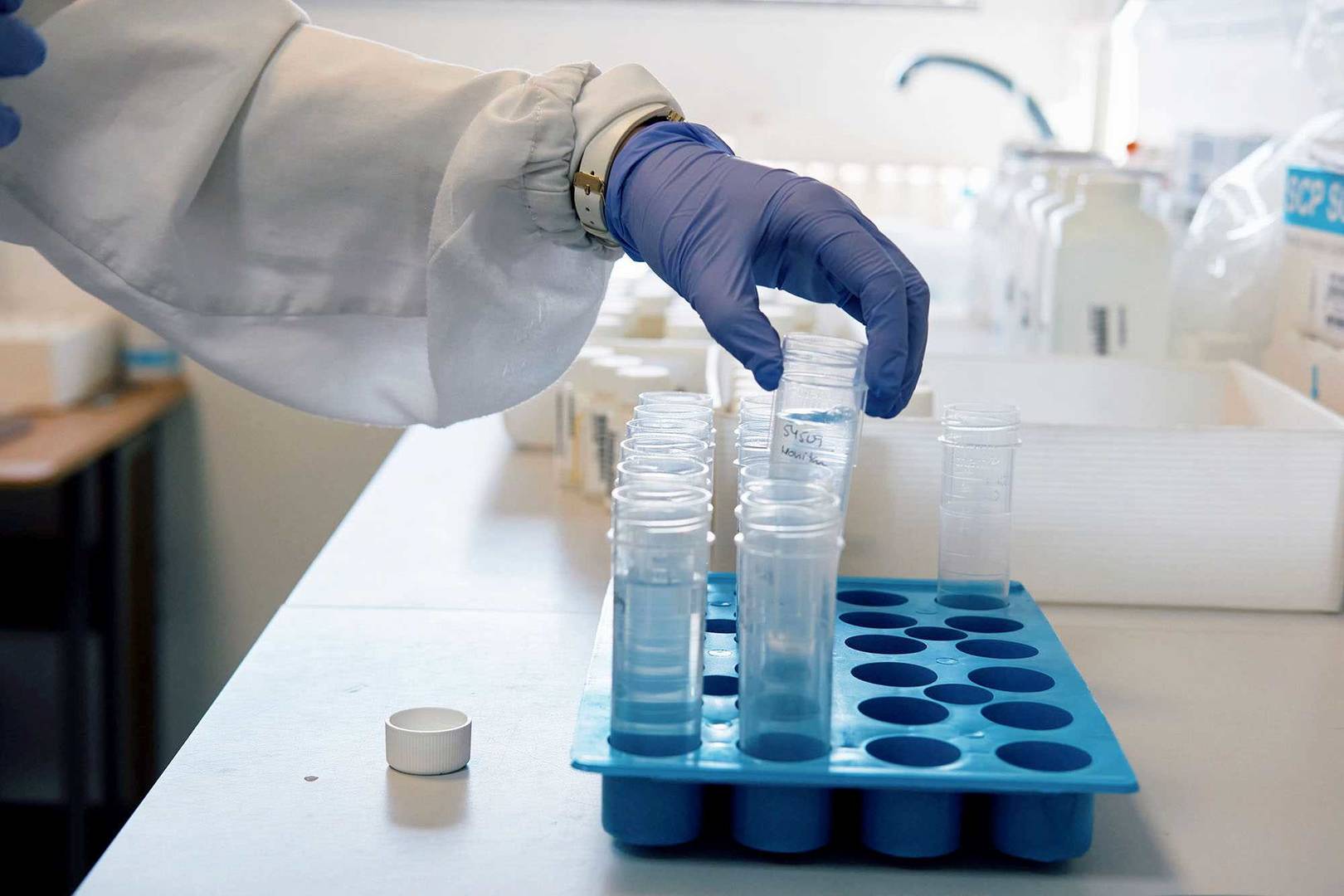 Laboratuvarda eldivenli bir kişinin test tüplerine sıvı eklediği yakın plan görüntü.