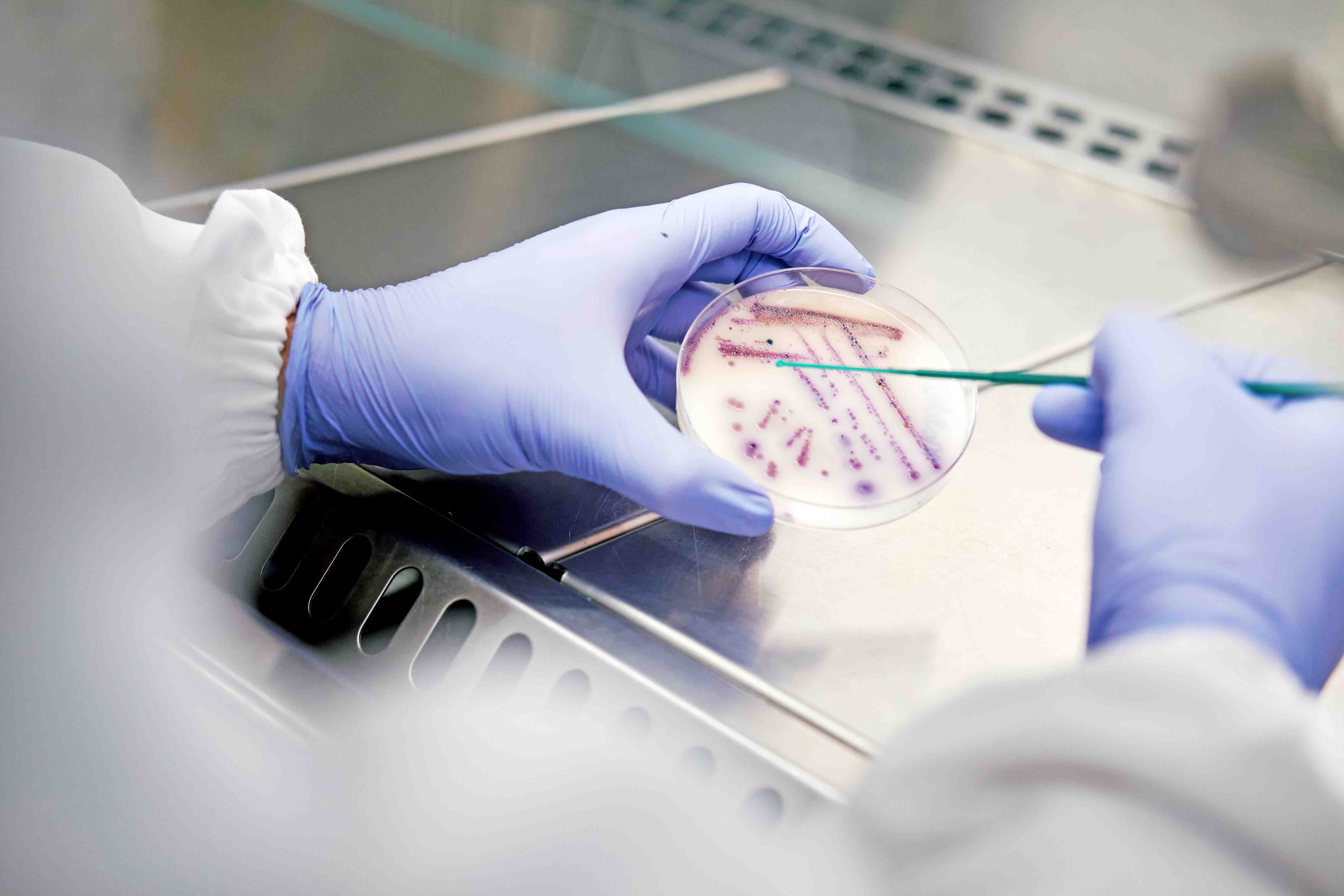 Cientista com luvas e vestuário de proteção a utilizar uma pipeta para analisar culturas bacterianas numa caixa de Petri.