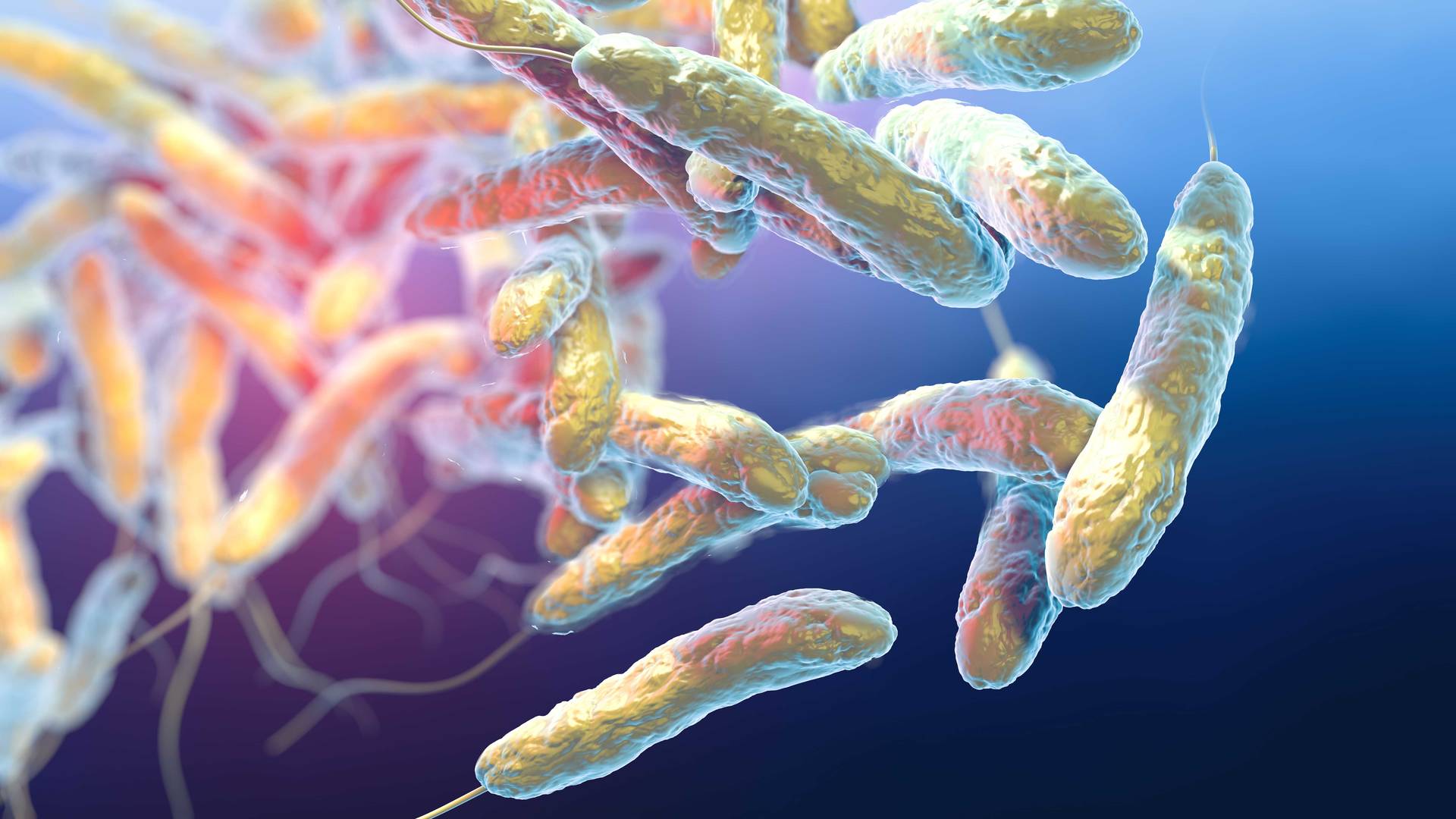 Legionella